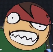 Sol's reaction.