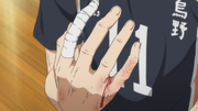 Tsukishima's injured hand.png