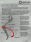 Clipboard sheet featuring the Advanced Knee Replacement specs.