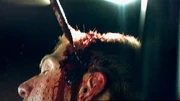 Richards takes a pen knife to the head