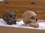 220px-H-floresiensis-Cretan-microcephalic