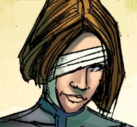 Келли вскоре после аугментации.