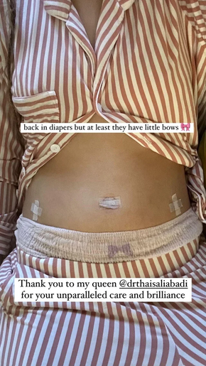 Halsey-Instagram-Story-Endometriosis-Surgery-March-2024