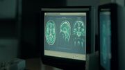 Encephalitis.jpg