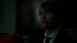 1x08 - Hannibal herido