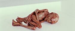 Anima mutilata di Voldemort