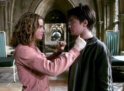 Hermione e Harry GiraTempo