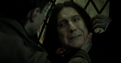 Você que foi Snape quem acertou a orelha de Jorge? #harrypotter