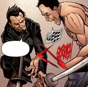 A Temnotiye loses his hand