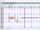 Melodyne