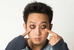 Bags under eyes.jpg