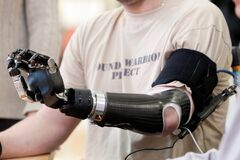 Human cybernetic arm