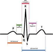 SinusRhythmLabels