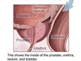 Prostate