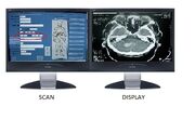 CT monitors