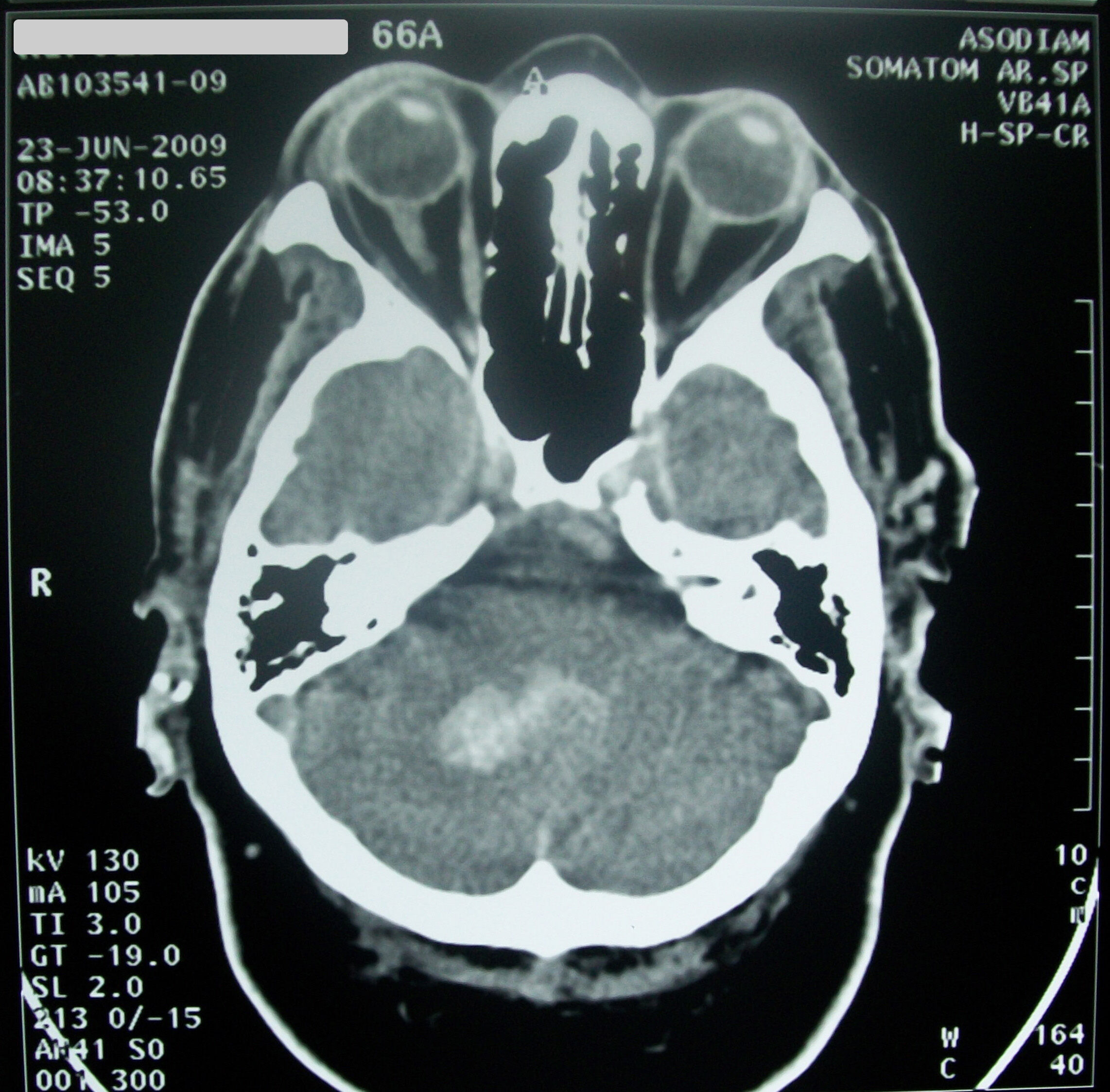 CT scan - Wikipedia