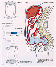 Peritoneal-dialyse