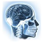 Neural Implant