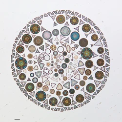 Arranged diatoms on microscope slide'"`UNIQ--ref-00000005-QINU`"'
