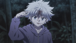 Killua after removing the needle EP94