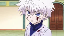 Killua after murdering Bodoro