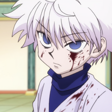 Killua Zoldyck Image Gallery Hunterpedia Fandom Killua Zoldyck Image Gallery Hunterpedia Fandom