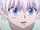 HxH2011 EP63 Killua slashed by Binolt.png