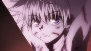 Killua tortured 2