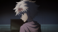 Killua dodges Palm's knife attack