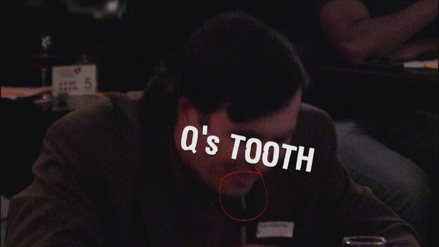 Q's tooth falls out during his turn in the challenge Disaster Dates.