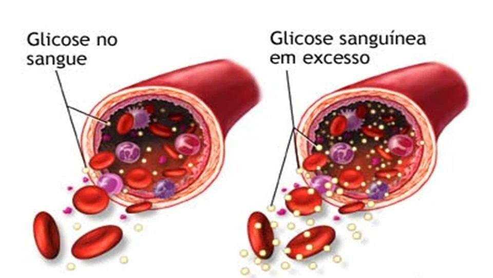 Blood Sugar Conversion Table: Easily Convert Between mmol/L and mg/dl