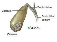 CalcBil2