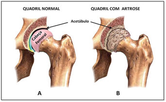 Thiago osteo1.jpg