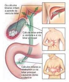 CalcBil4