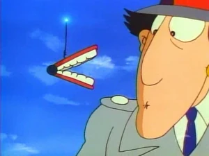 Gadget Teeth Romanova