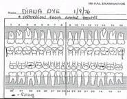 Dental chart (note misspelling of first name)