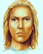 Sketch of abductor