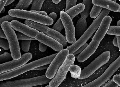 Deinococcus radiodurans - microbewiki