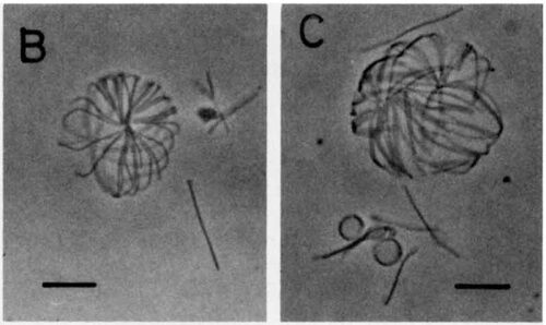 Deinococcus - microbewiki