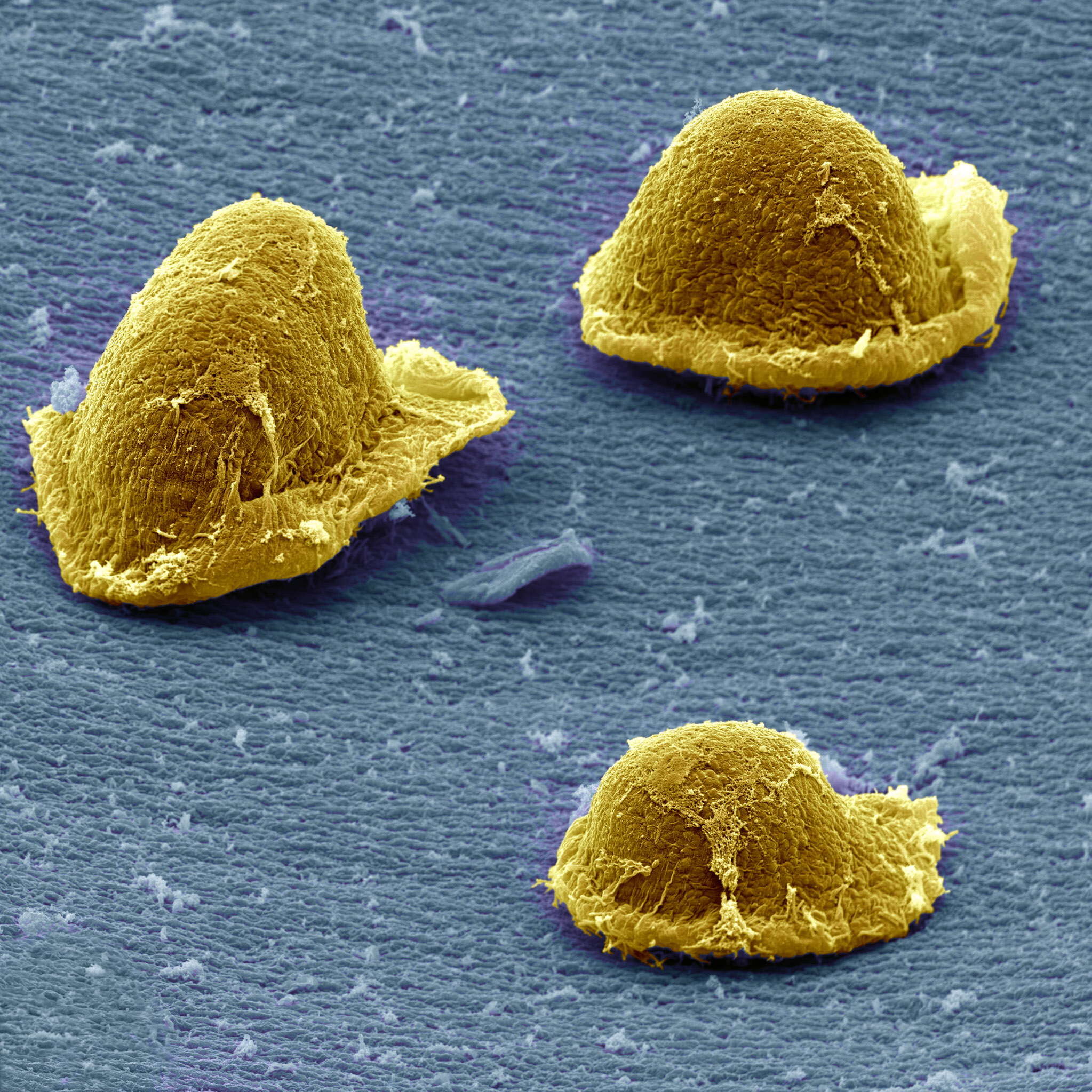 Deinococcus - microbewiki