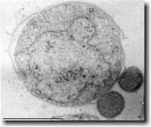 Deinococcus radiodurans - microbewiki