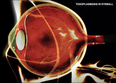 Toxoplasma-gondii-toxoplasmosis