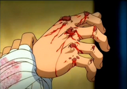 Ippo's hand damaged after he punched a sandbag