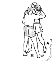 [A] se rapproche de l’opposant pour l’empêcher de s’exprimer en coups longs