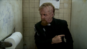 Cricket's burn scars '"`UNIQ--nowiki-00000037-QINU`"''"`UNIQ--nowiki-00000038-QINU`"'