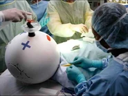 Jack being operated on after he was hit by a bus.