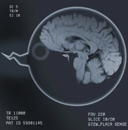 Jackxray-cheetahchristina.jpg (342 KB) An x-ray of Jack's head after he was hit by a bus.
