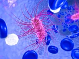 1992-1993 E. coli outbreak