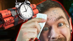 NERVOUS SWEATING image