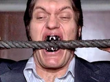 Jaws' Metal Teeth